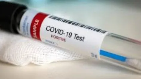 Un estudio revela que el Covid-19 deteriora el sistema inmunitario a largo plazo